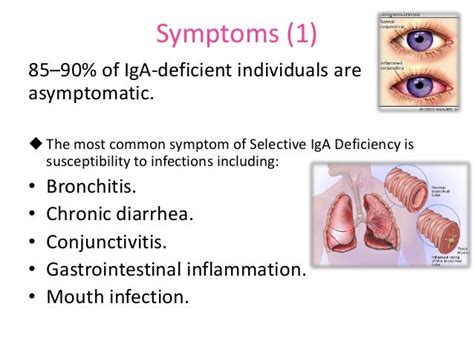 iga deficiency symptoms
